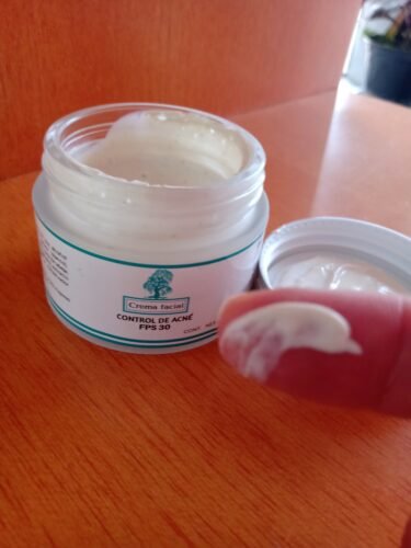 Crema Facial  Control de Acné photo review