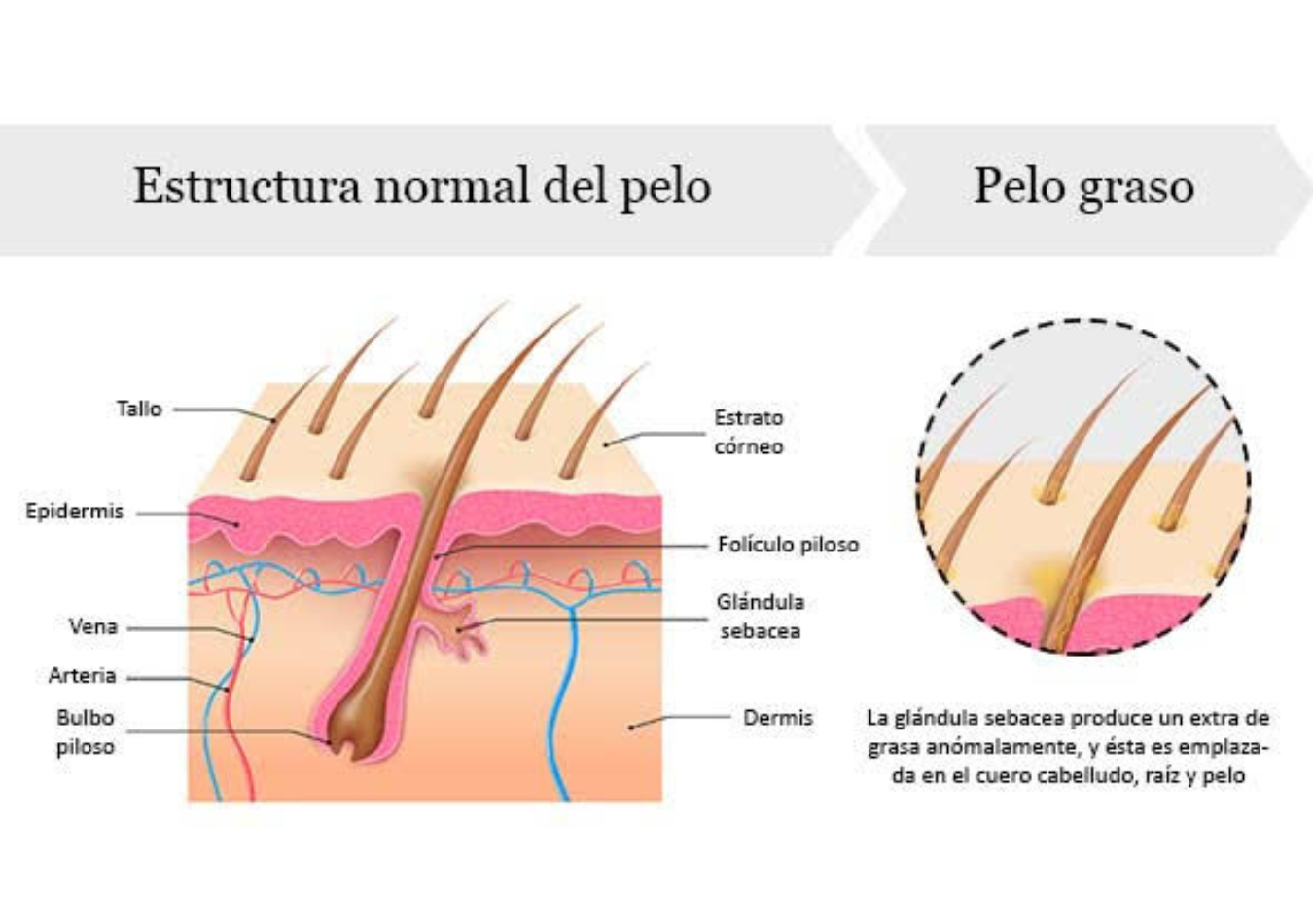 PElo graso